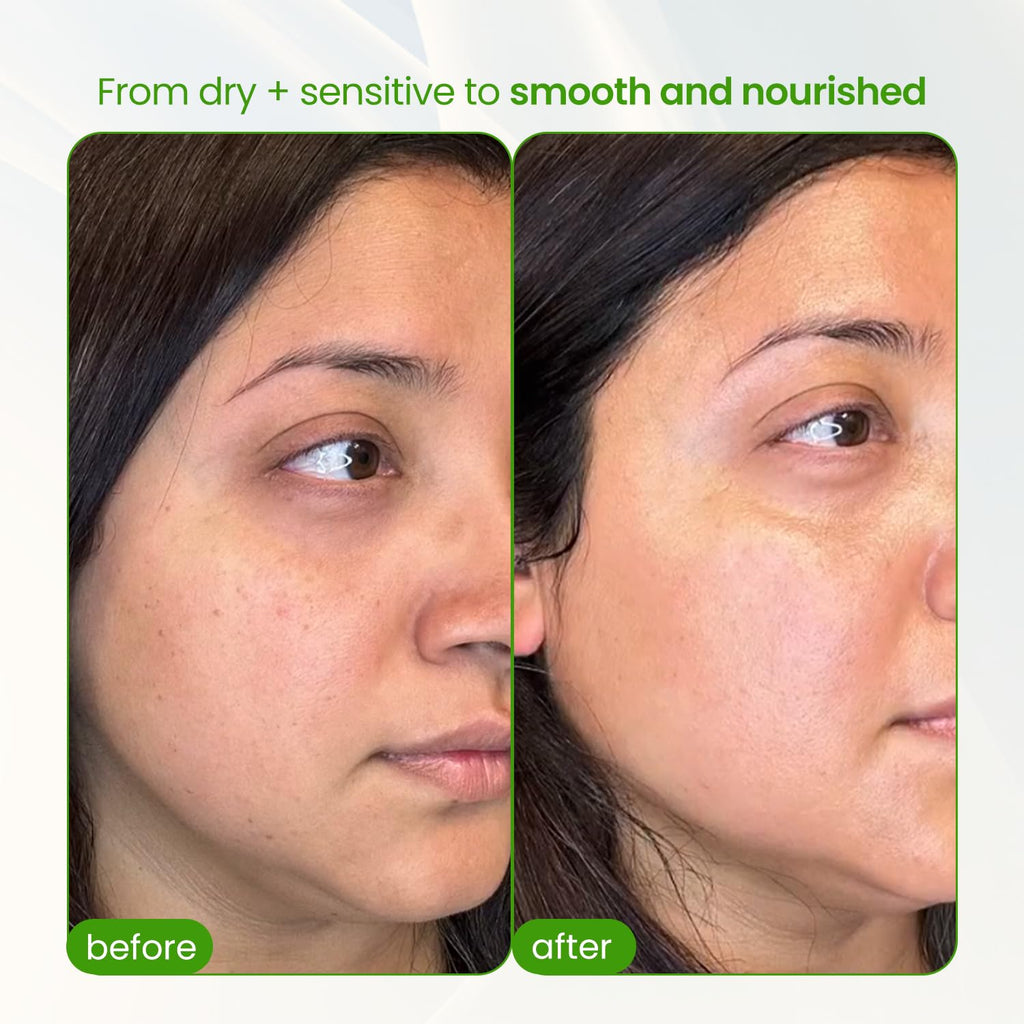 Barrier Repair Organic Face Cream Moisturizer with Ceramides Squalane Centella & Niacinamide, Fragrance Free, Non-Comedogenic, Gentle Soothing Hydration for Dry, Sensitive, Normal Skin, Travel Size