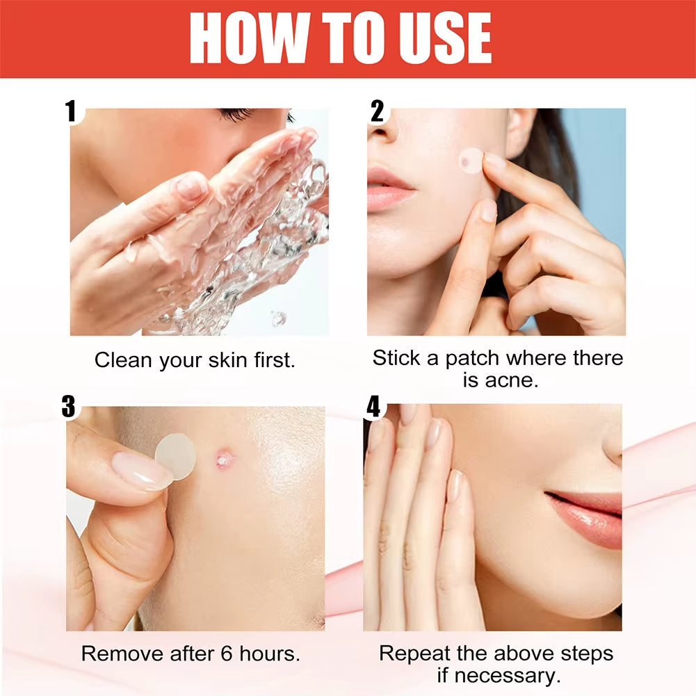 144Pcs/Set Face Skin Care Acne Pimple Patch 2 Sizes Invisible Professional Healing Absorbing Spot Sticker Covering for Men Women